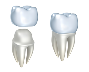 Dental Crowns | Dentist In Fargo, ND | Tronsgard & Sullivan, DDS